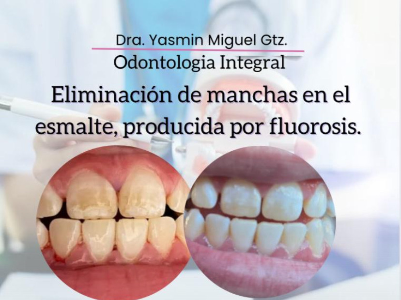 Consultorio Dental Yasmin Miguel